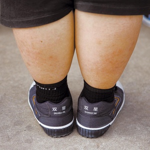 Parto cesariano é fator de risco para a obesidade em adultos jovens, segundo os pesquisadores - China Photos/Getty Images